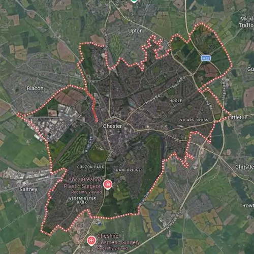 Chester Map Image - AB